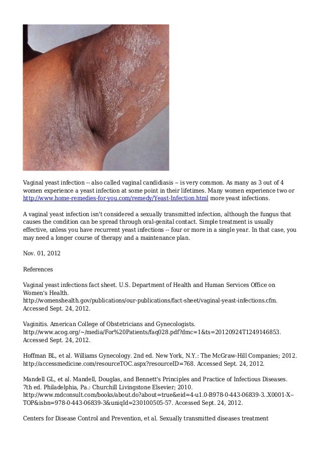 pictures of vaginal disease Pictures of vaginal disease